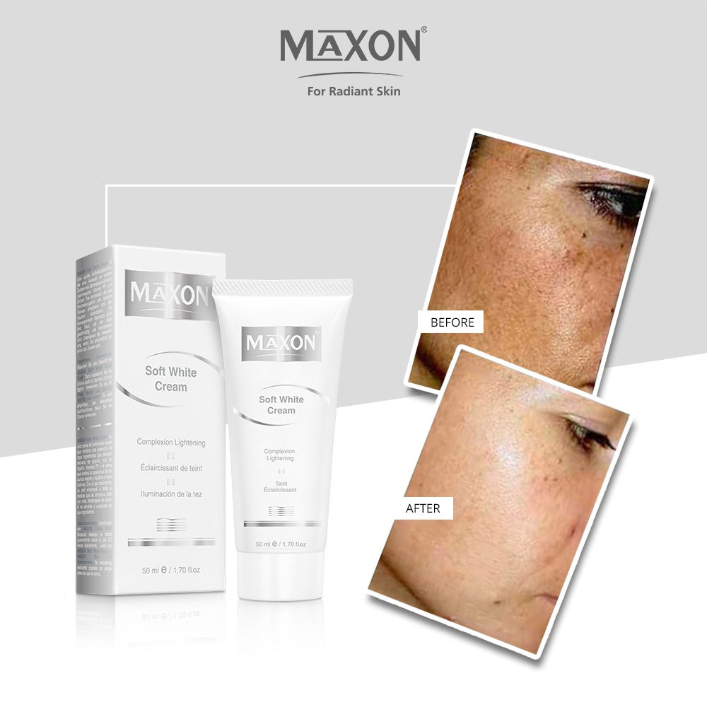 MAXON Soft White Cream ( 50 ml )