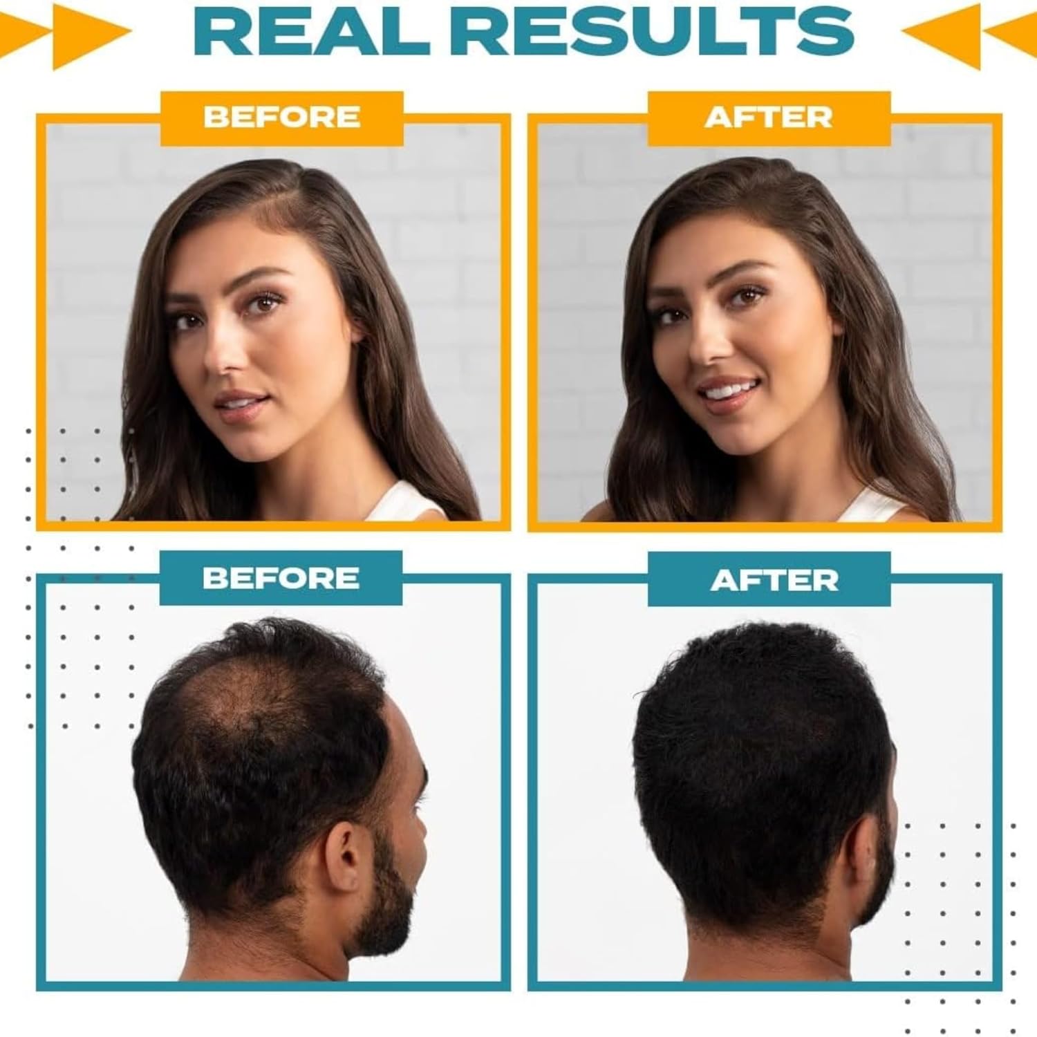 Toppik Hair Perfecting Tool Kit 3pcs Set