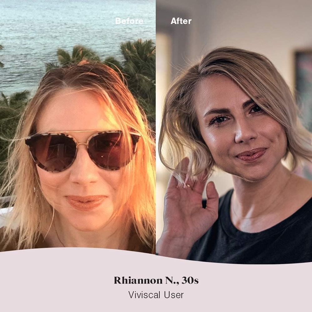 Viviscal Strengthening Conditioner – Nourish & Protect Your Hair | Deep Conditioning Treatment - 250m