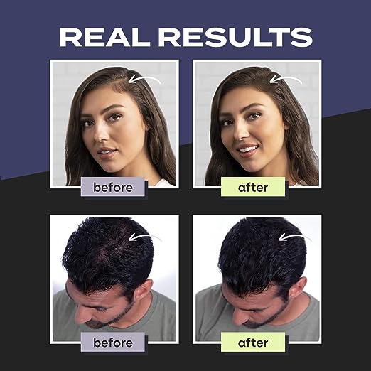 Toppik Hair Fibers Value Set