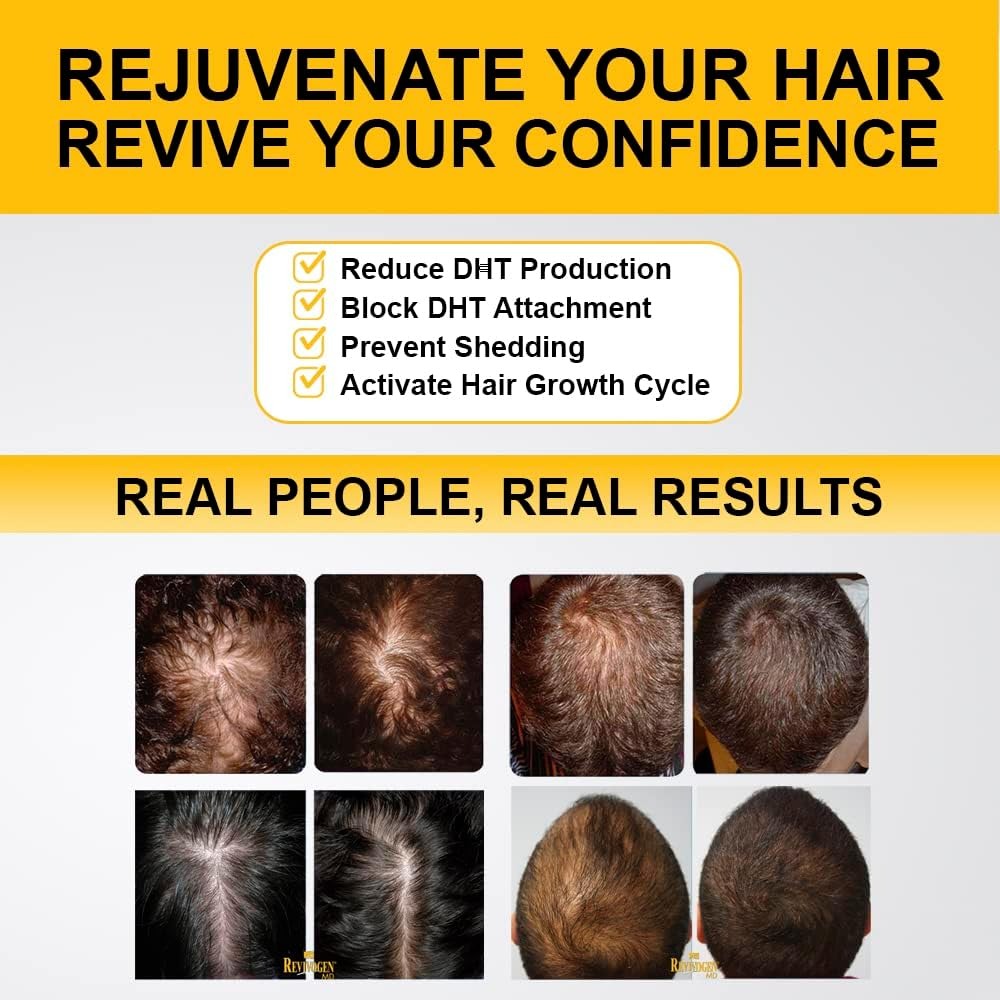 Revivogen MD Bio-Cleansing Shampoo