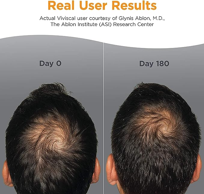 Viviscal Full Force Fortifying Shampoo For Men - 250ml