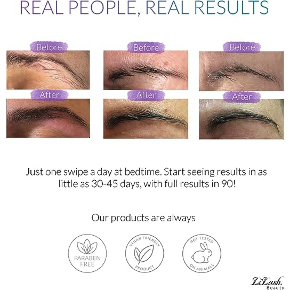 EyeLash & EyeBrow Growth Serum Set - 2ml (3 Month supply)