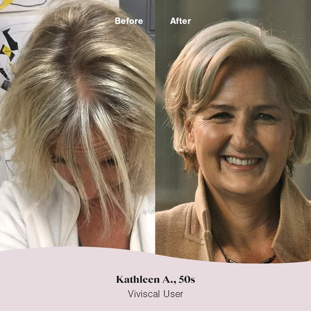 Viviscal Strengthening Conditioner – Nourish & Protect Your Hair | Deep Conditioning Treatment - 250m