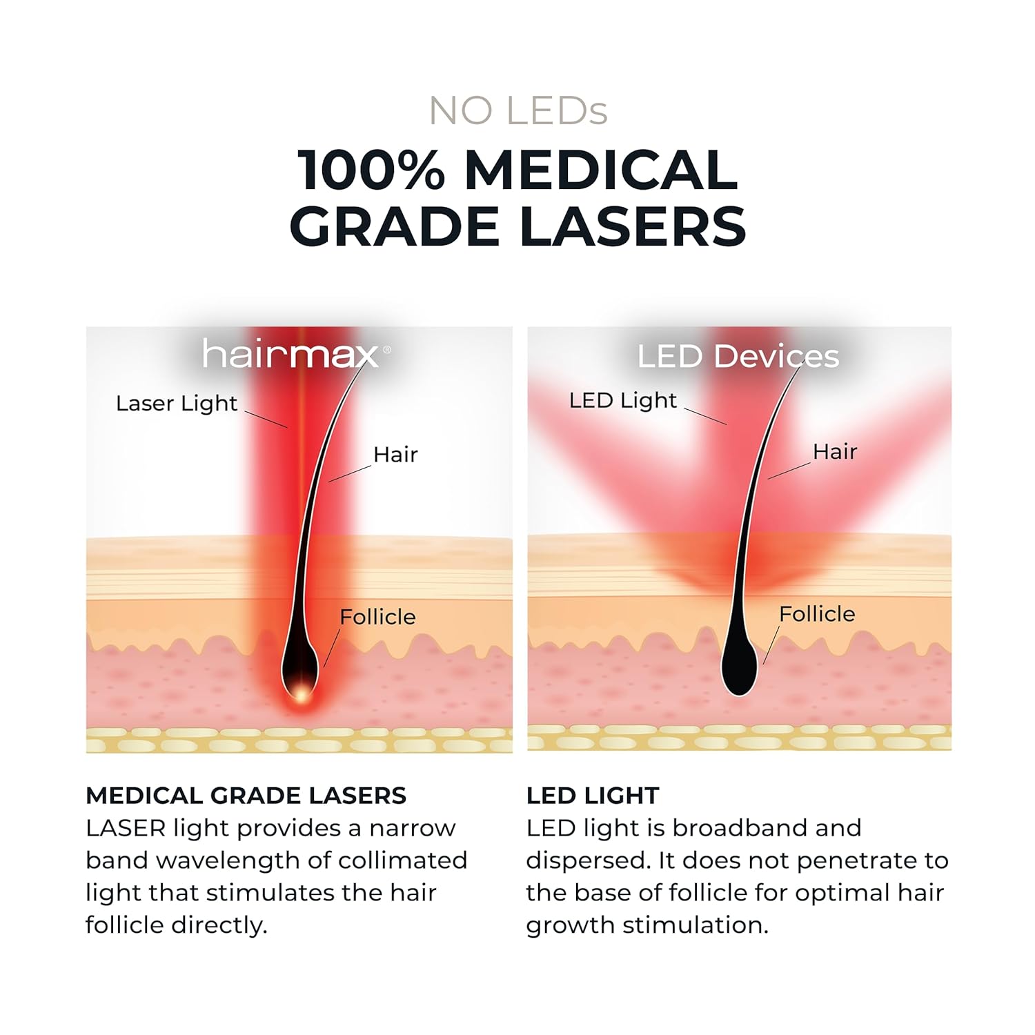 HairMax Ultima 12 Classic LaserComb Hair Growth Device (FDA Approved)