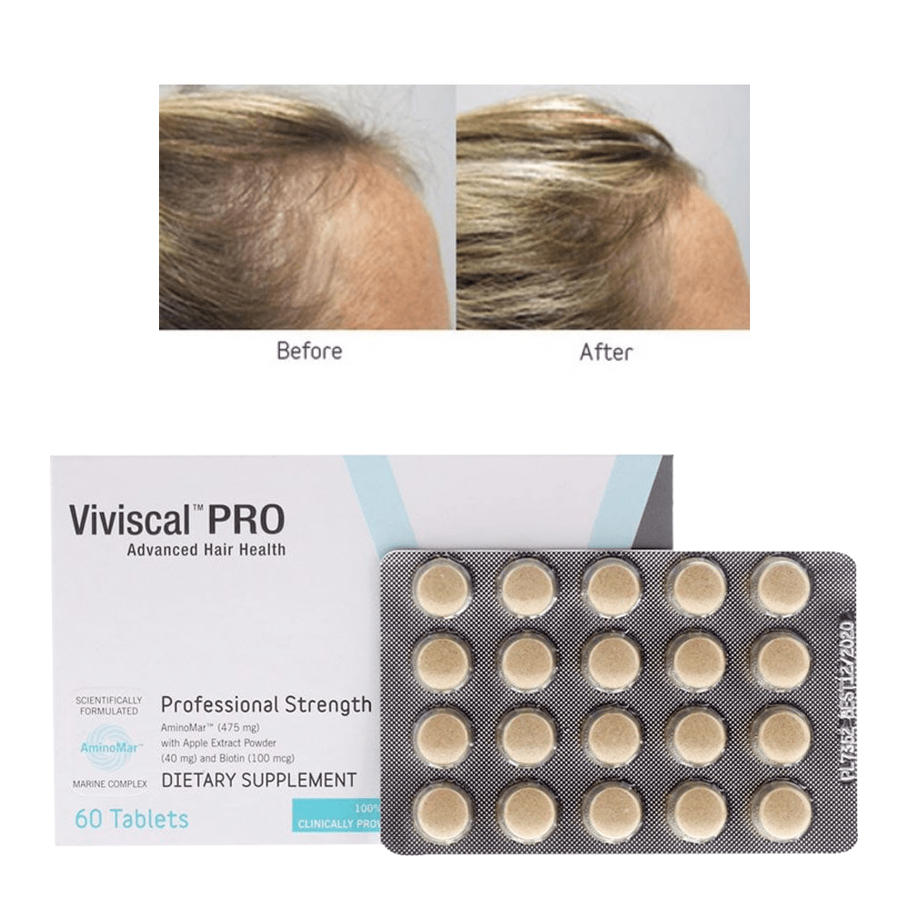 Viviscal Professional Hair Growth Supplements – Clinically Proven Hair Loss Solution for Men &amp; Women 60 Tablets (1 Months Supply)