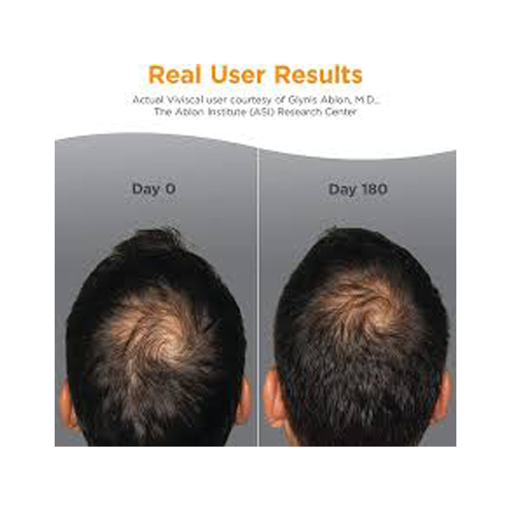 Viviscal Man Hair Growth Supplements For Men | Effective Hair Loss Solutions for Men - 180 Tabs (3 month Supply)