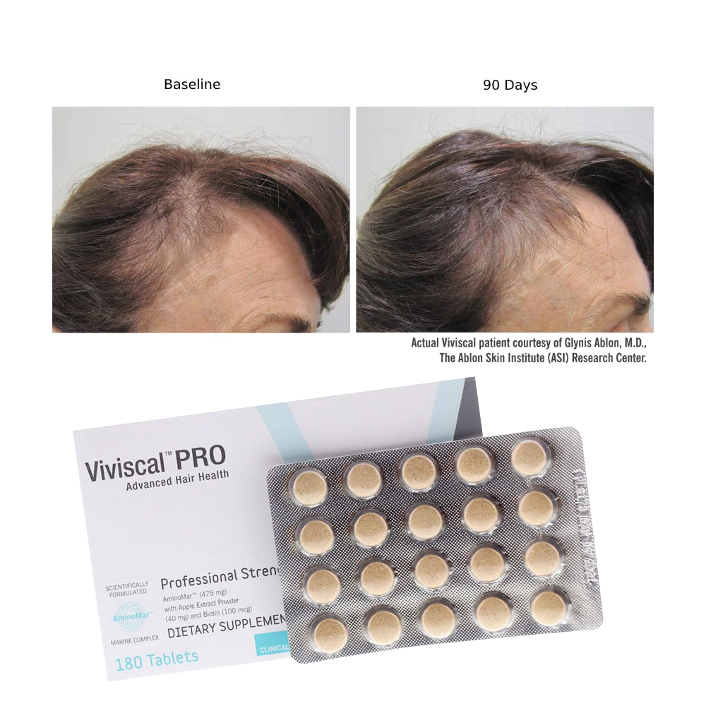 Viviscal Professional Hair Growth Supplements – Clinically Proven Hair Loss Solution for Men & Women 180 Tablets (3 Months Supply)