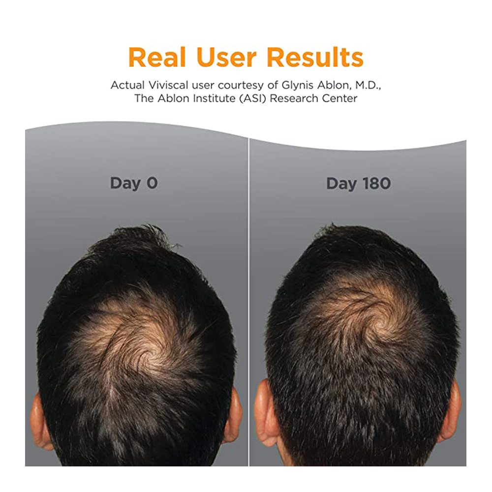 Viviscal Man Hair Growth Supplements For Men | Effective Hair Loss Solutions for Men - 60 Tablets (1 month Supply)
